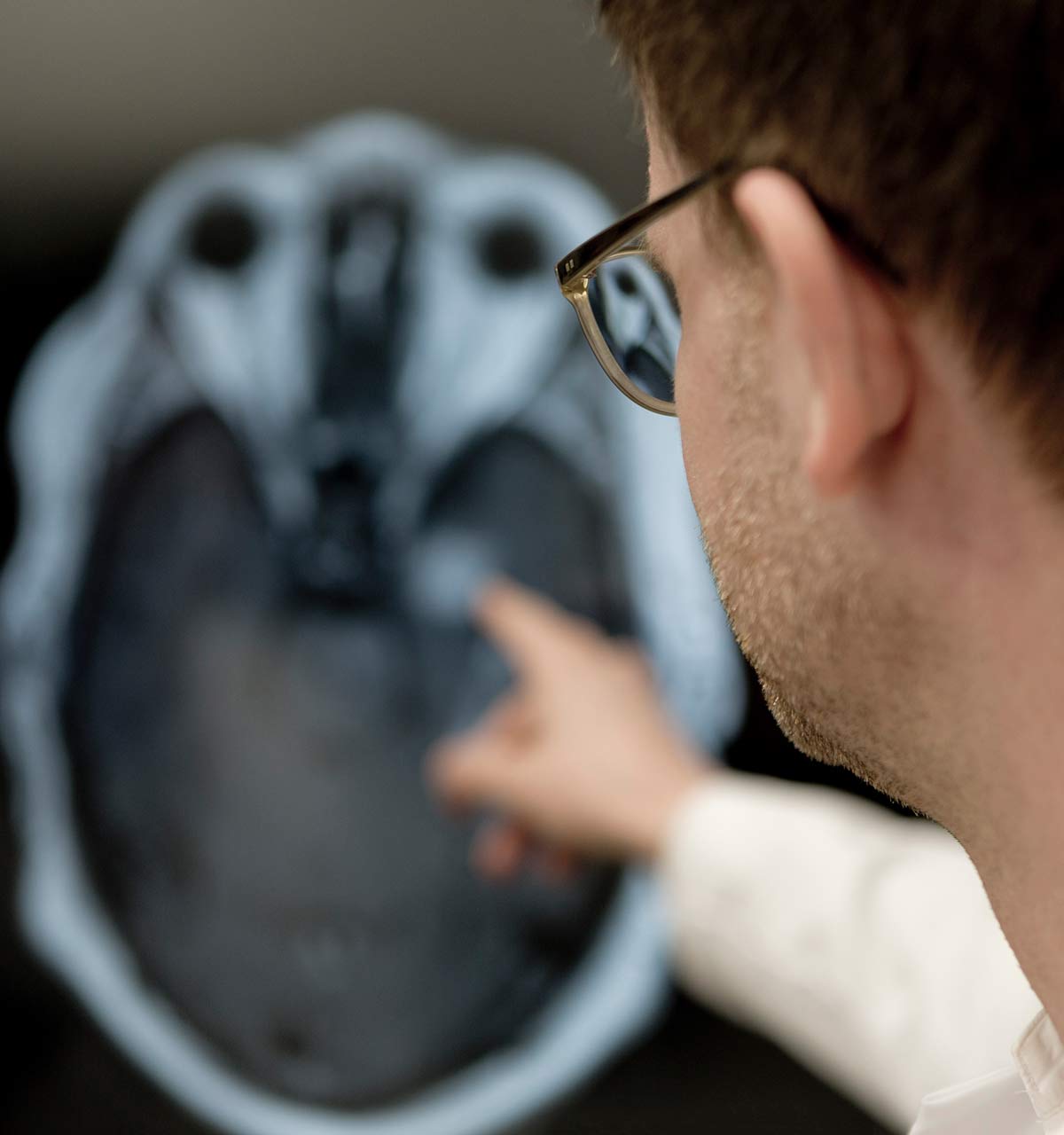dkfz-translationale-neuroonkologie-essen_20